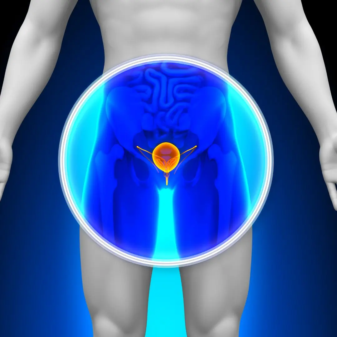 Bladder Irrigation: Understanding the Procedure and Its Benefits