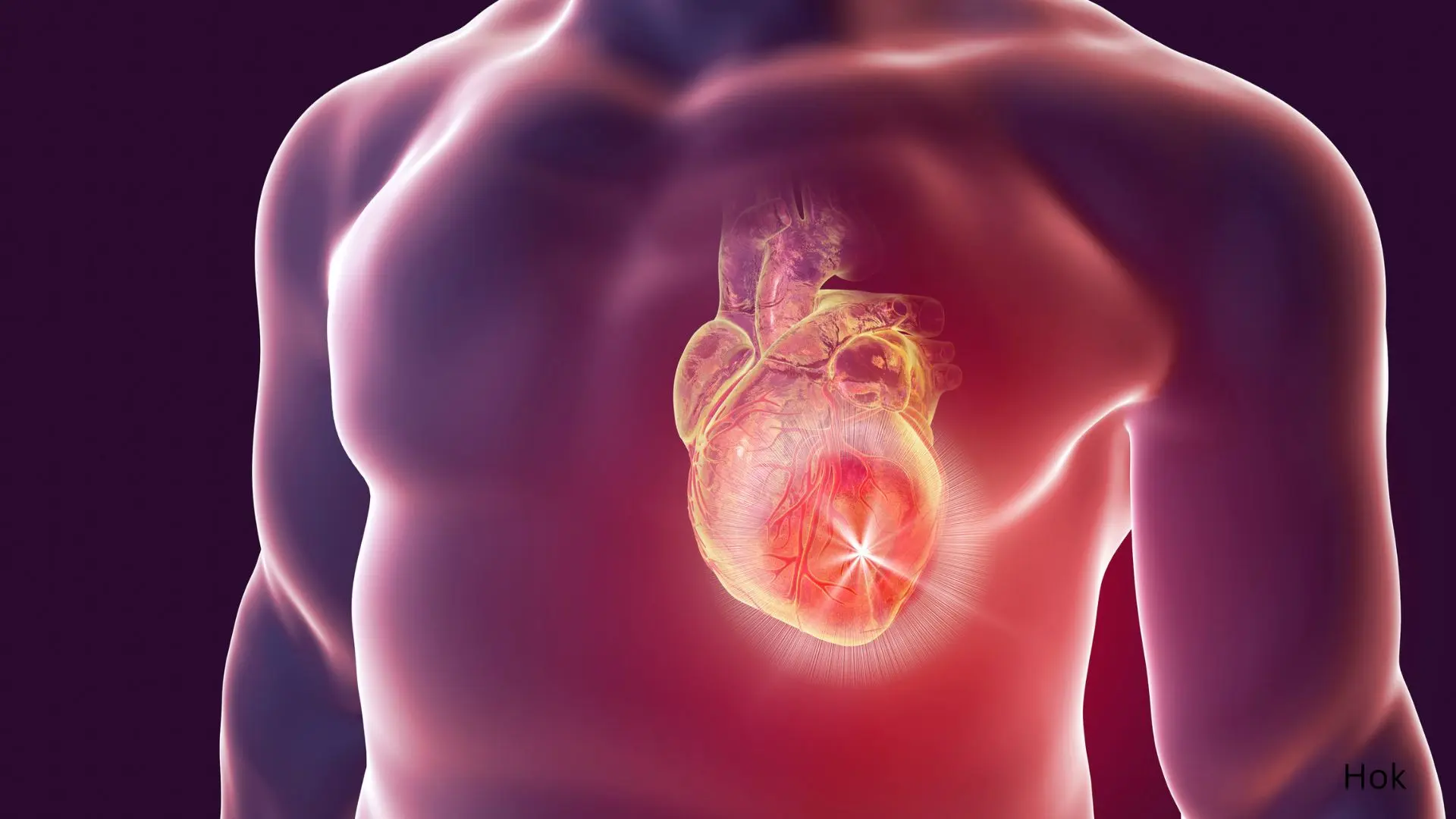 Nursing Care Plan for Myocardial Infarction: A Comprehensive Guide