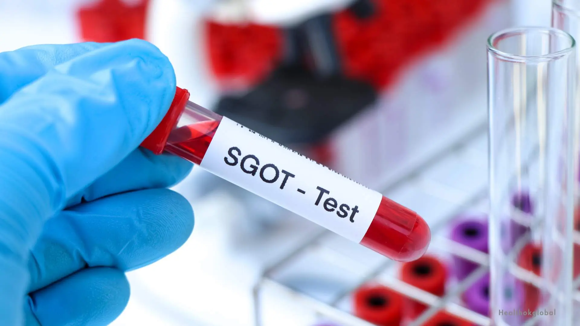 SGOT High Means: Causes, Diagnosis, and Treatment