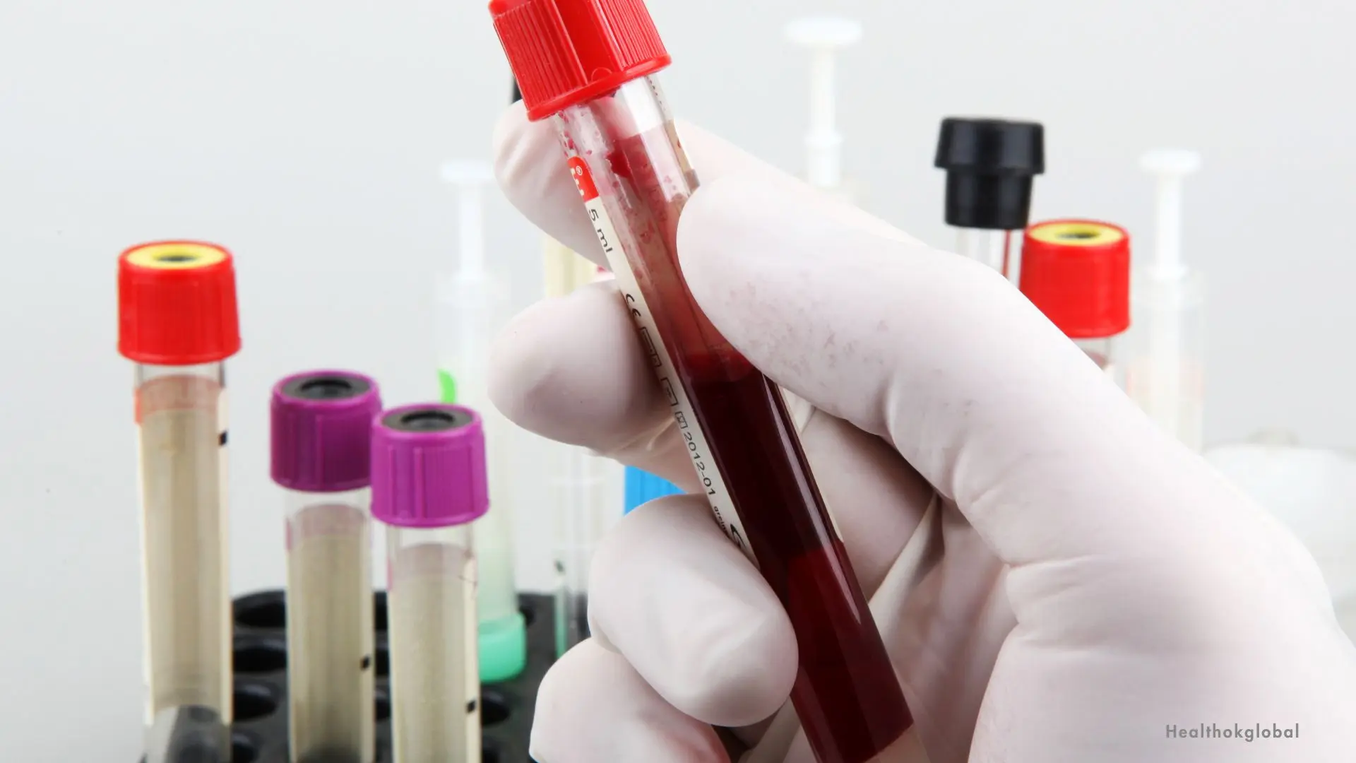Understanding PCV Normal Range: Importance and Health Implications
