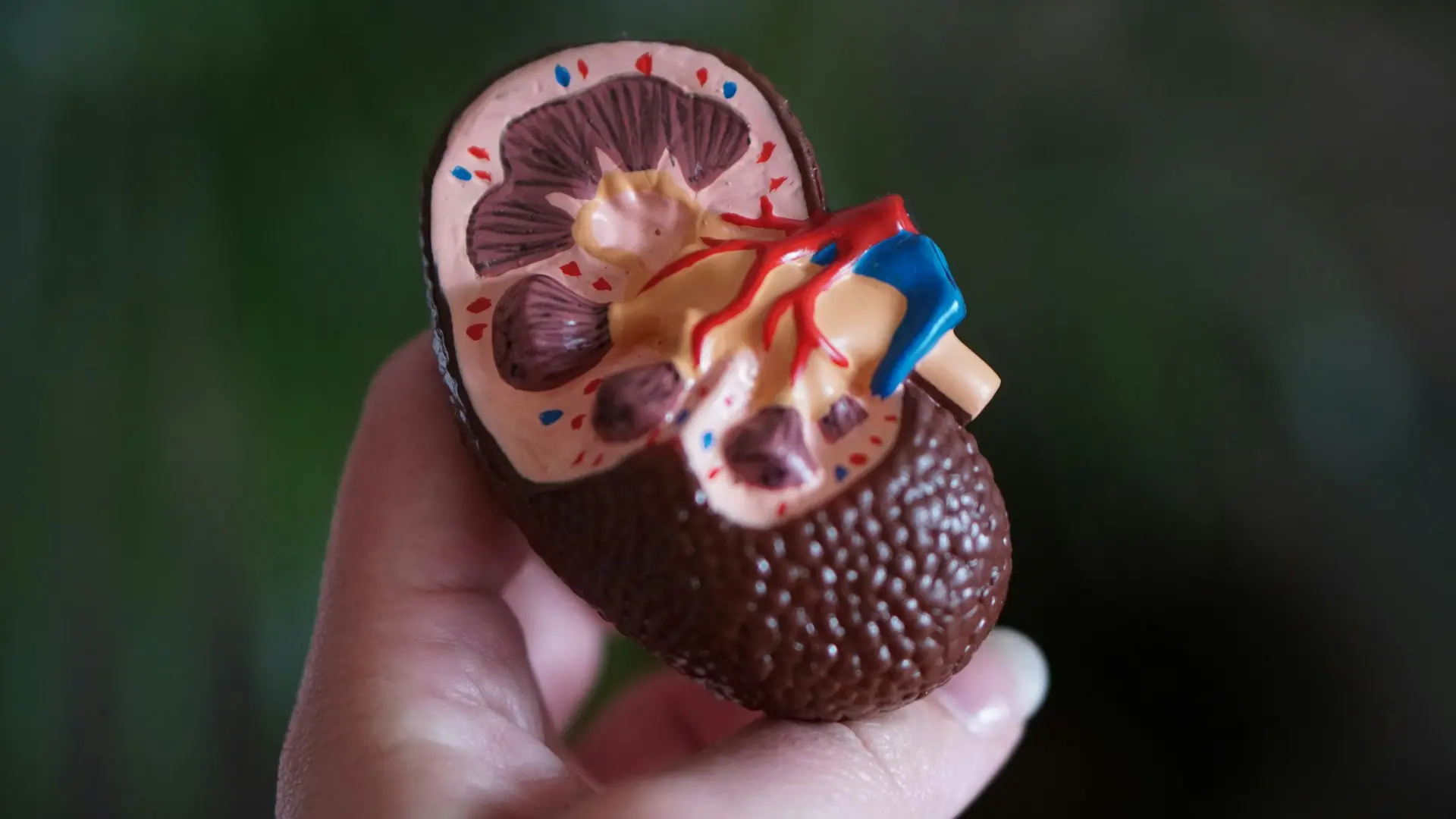 Understanding Stage 3 Chronic Kidney Disease