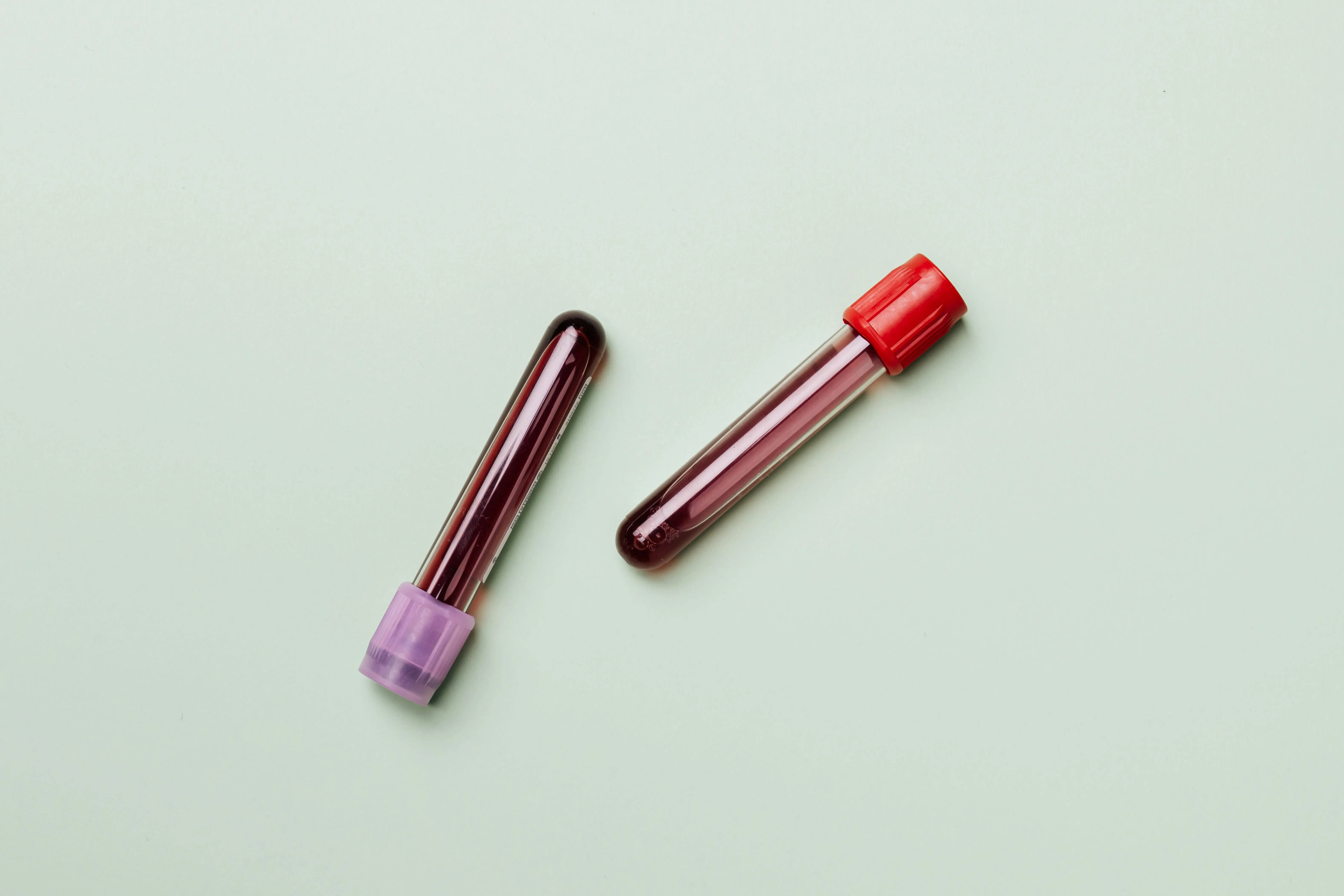 Widal Test for Typhoid Fever: Purpose, Procedure, and Accuracy