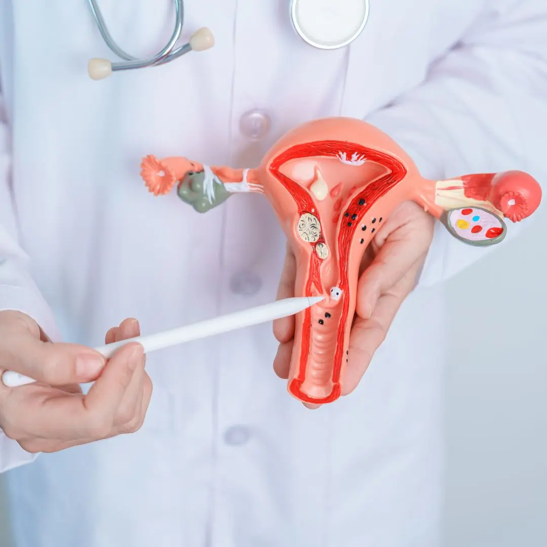 Pathophysiology of Cervical Cancer