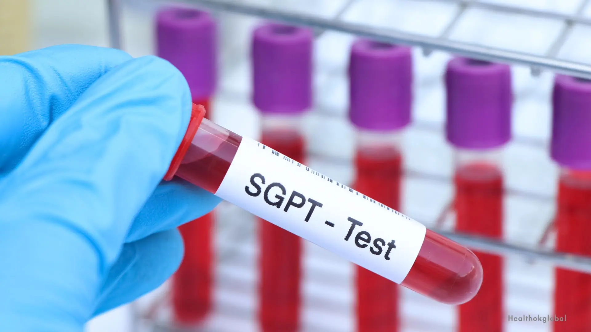 SGPT normal range