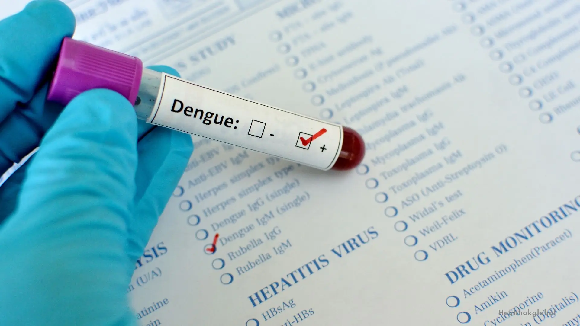 dengue ns1 test