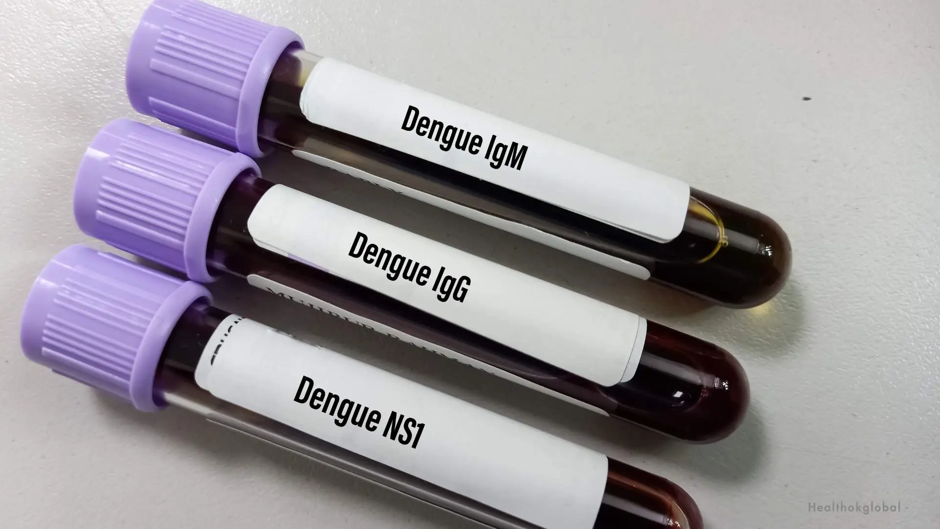 ns1 antigen test