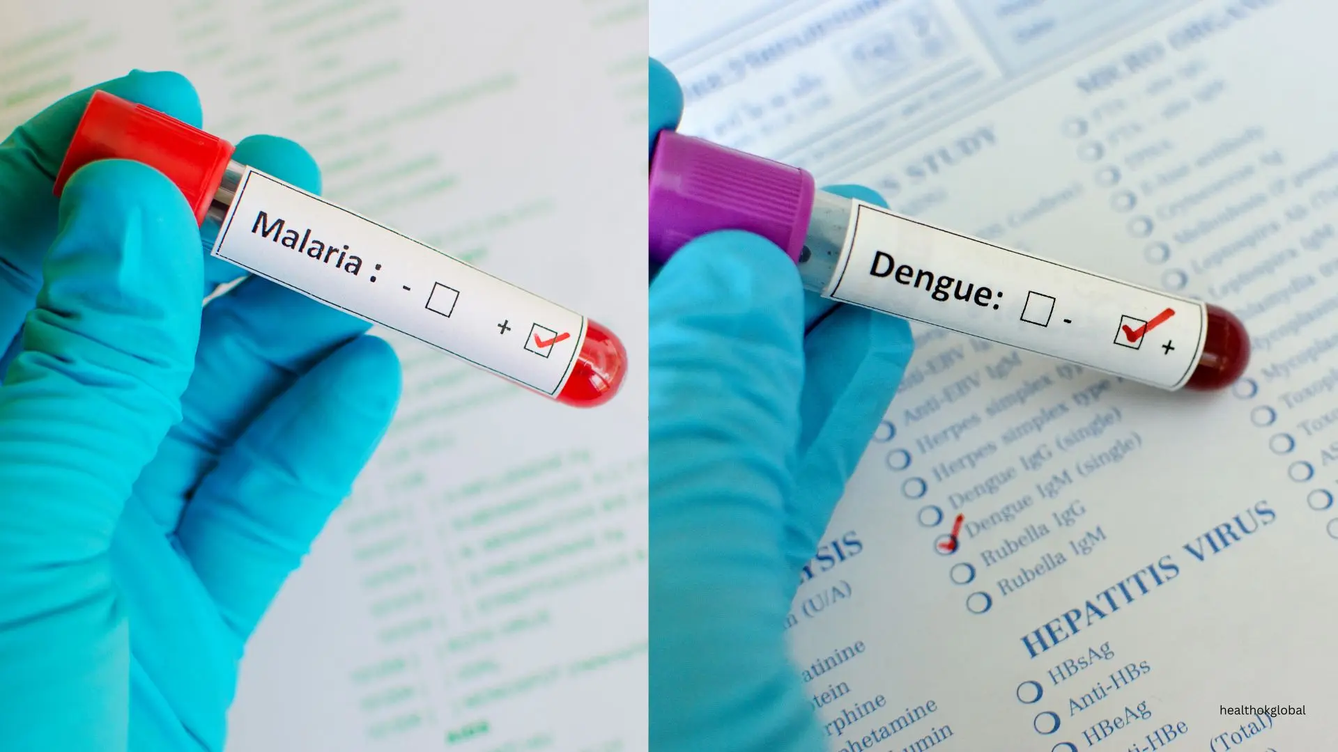 malaria vs dengue symptoms