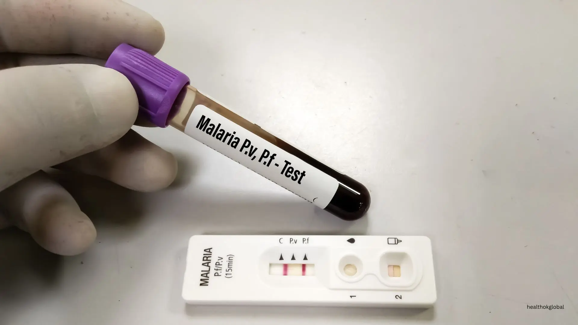 diagnostic tests for malaria