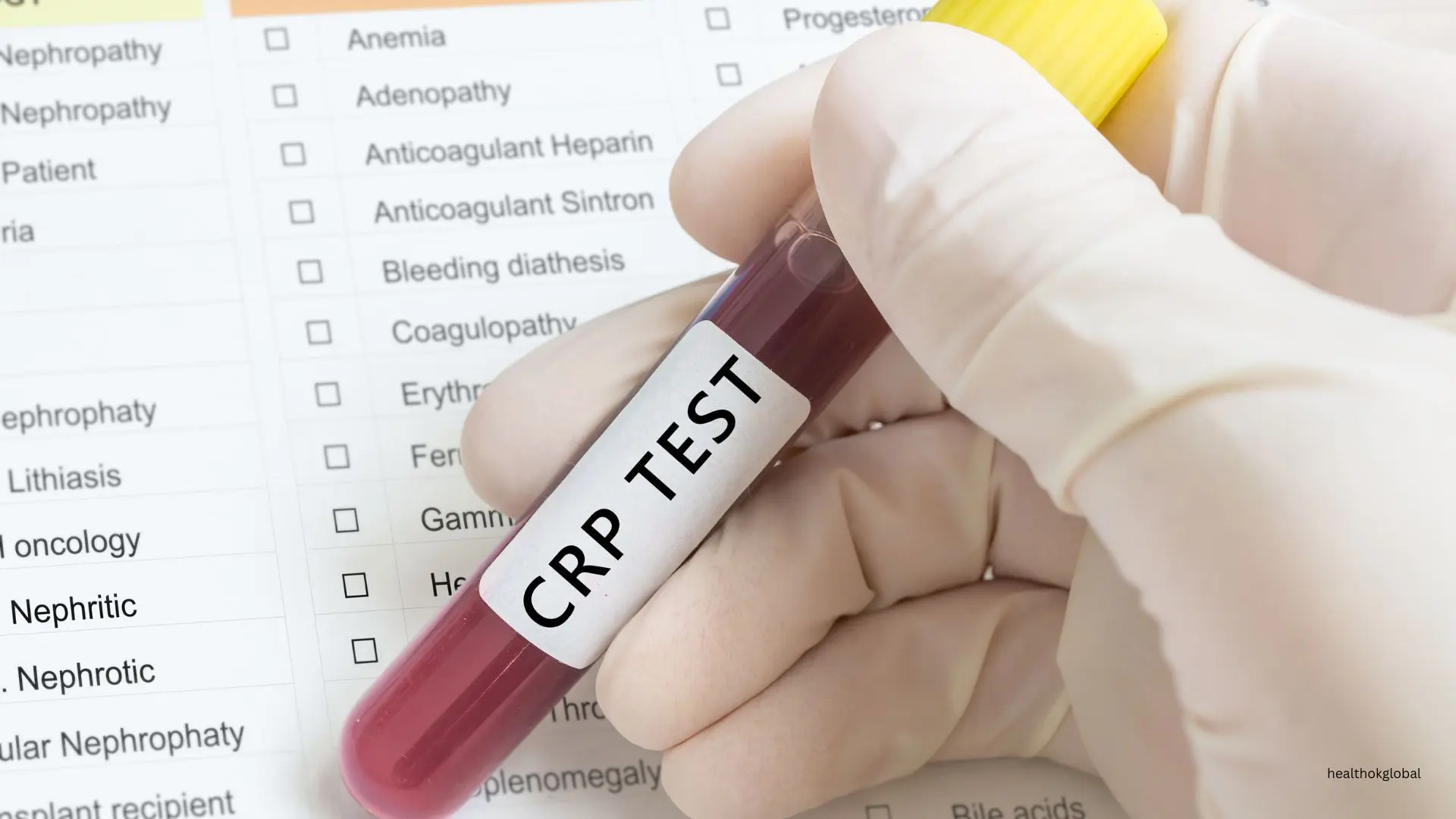 CRP in COVID Pneumonia