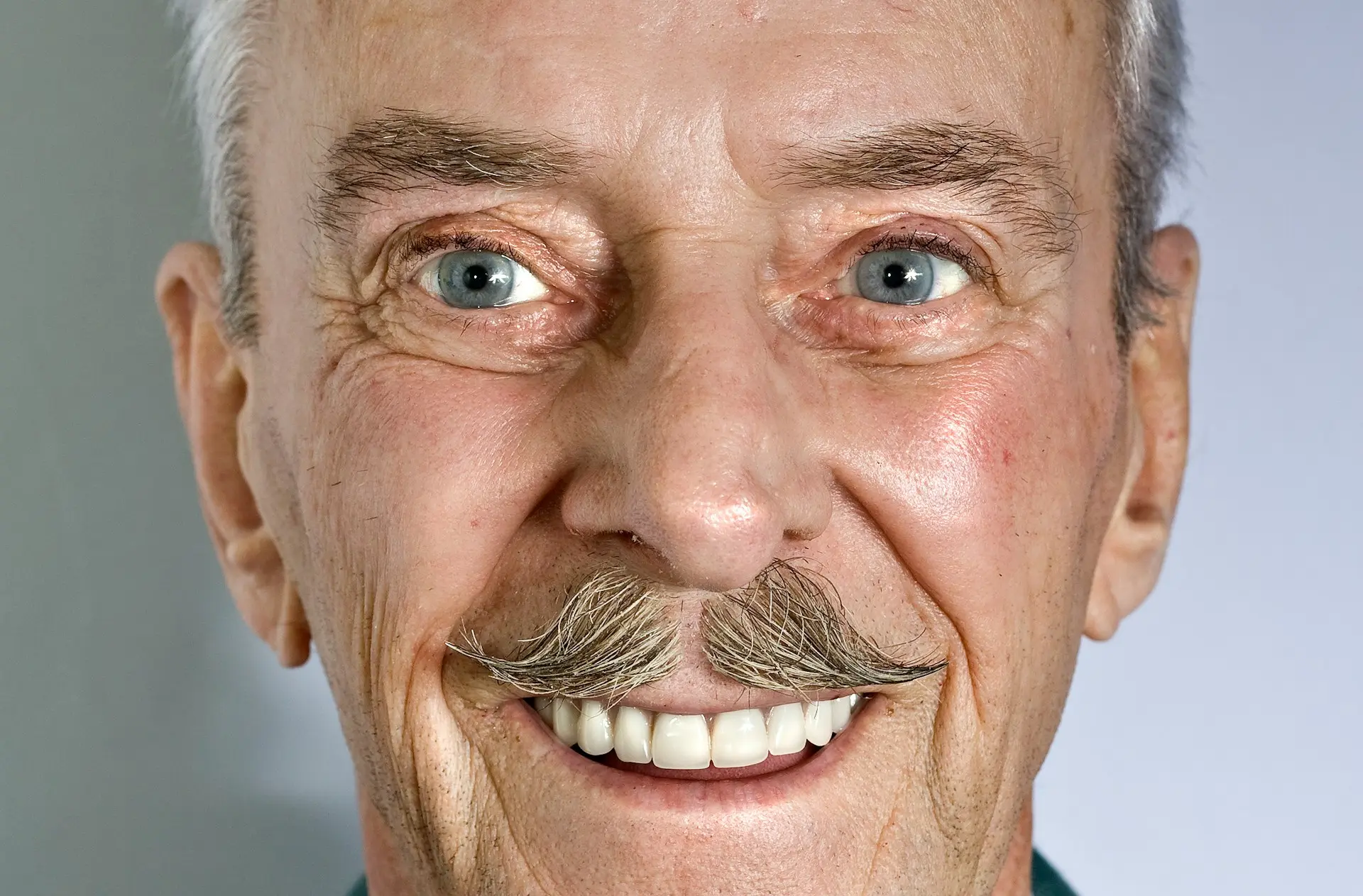 Close-up of an elderly man with bright, clear eyes and a cheerful expression, symbolizing successful senile cataract treatment and improved vision.