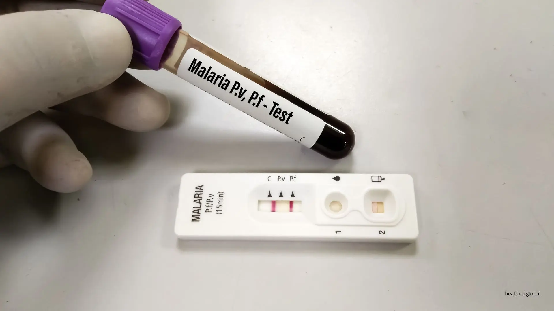 Rapid Malaria Detection with Test Kits