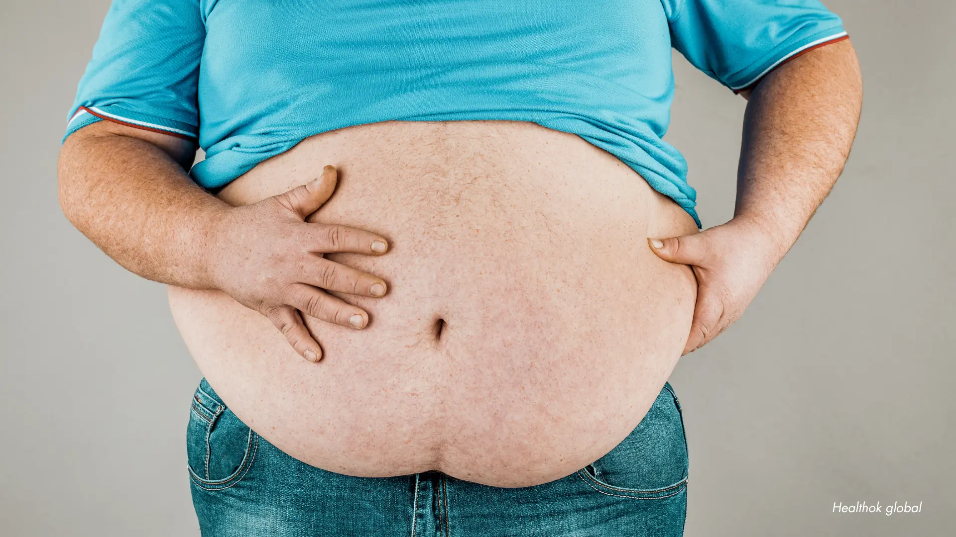 A comprehensive illustration highlighting obesity classifications, health risks, and care strategies for long-term wellness.
