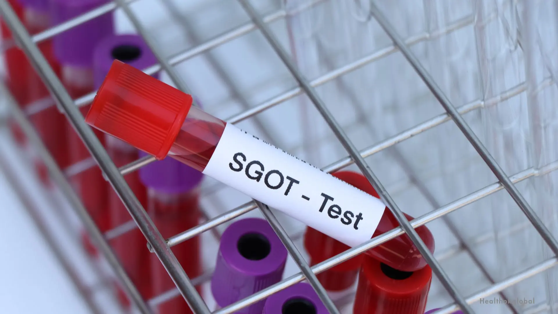Normal SGOT enzyme levels and their significance